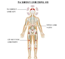 두뇌 임플란트로 생각만으로 걷는다