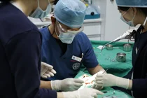 고난이도 수술인 임플란트, 정밀 진단 후 맞춤형 계획 수립이 필수