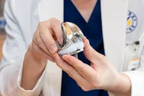 한국형 인공관절, 움직임·이물감 없는 사용감으로 환자 치료 적용