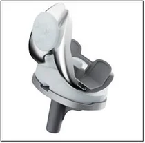 한국인 데이터로 만든 인공관절, 美 FDA 승인