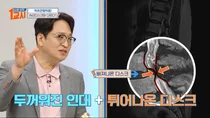 유정수 병원장, MBC ‘나를 살리는 1교시’서 ‘척추관협착증 예방 및 치료법’ 강연
