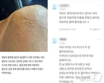 집에 돌아왔지만..전기차 화재 청라 주민들 '기침, 피부질환...분진 고통'