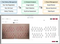아모레퍼시픽, AI 기반 피부자극 자동진단기술 발표