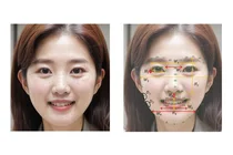 LG생건, Vision AI기술로 얼굴 부위별 노화 시계 비밀 밝혀