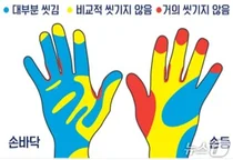남자 10명 중 2명, 여자 10명 중 1명 용변 보고 손 안씻는다