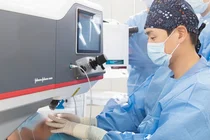 실크 스마일라식, 다른 스마일라식과 다른 점은?