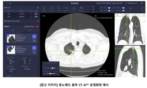 '제2의 루닛' 뷰노, 브라질서 AI 의료기기 2종 인증..52주 신고가