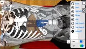 '네이버커뮤니케이션즈+이대목동병원', '이음5G'로 AI 의료서비스 제공한다