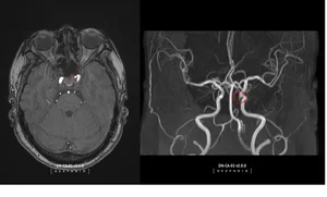 유상증자에도 거침없는 딥노이드, 내년엔 실적 터진다