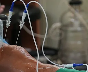 고주파 열 치료술, 인공관절 수술 후 통증 개선 도와