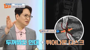 유정수 병원장, MBC ‘나를 살리는 1교시’서 ‘척추관협착증 예방 및 치료법’ 강연