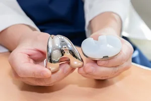 한국형 인공관절 수술 후, 간호간병 통합서비스로 환자 부담 줄일 수 있어