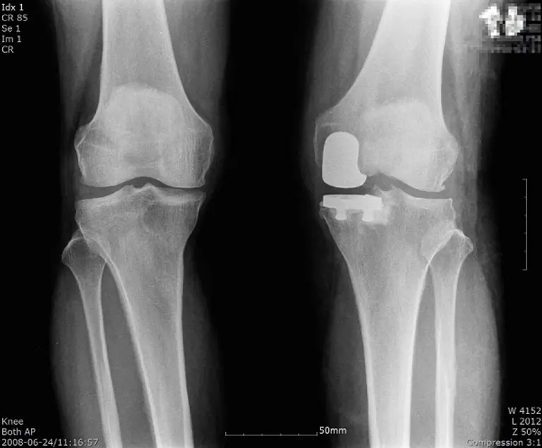 사진=연세사랑병원