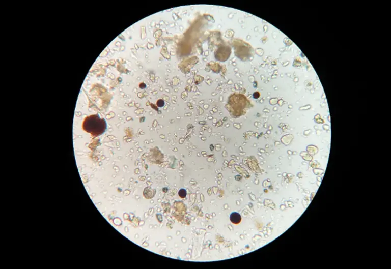  * 현미경으로 들여다 본 토양 미생물. 사진=픽사베이