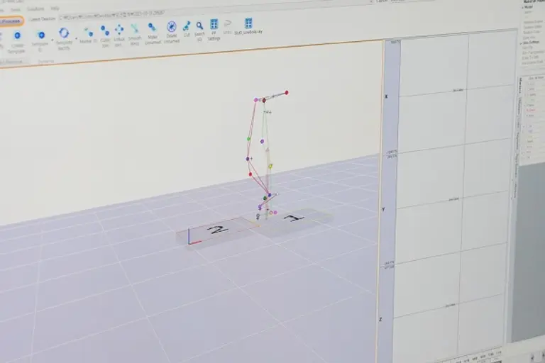 인공관절 수술 환자의 수술 전후 보행을 분석하는 모션캡쳐(동작분석) 실시 장면