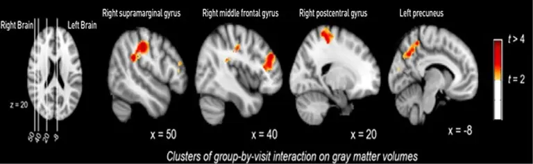 흰목이버섯 이미지
