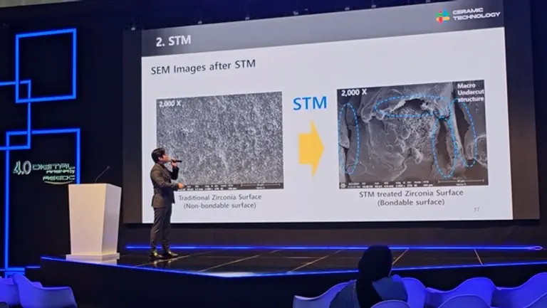  * AEEDC Digital Dentistry 4.0 관 강연장에서 STM 연구 성과를 발표중인 세라믹테크놀로지 연구소장.